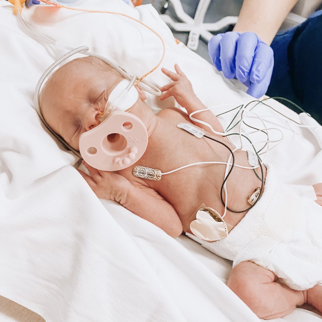Preterm Pacifier When To Introduce a Pacifier to a Preemie | Ryan & Rose – Ryan And Rose